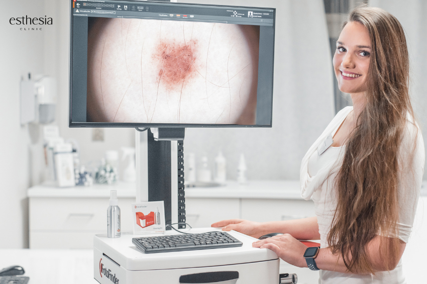 DenMelanomu