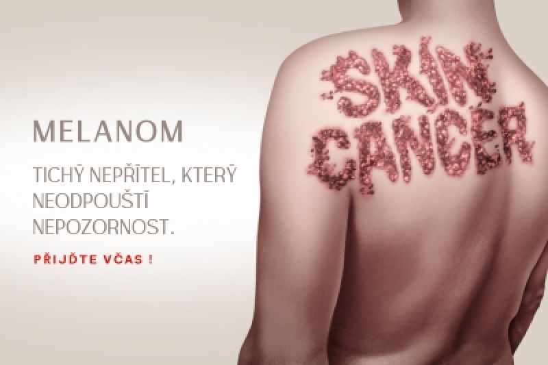 MELANOM - Neodpouští nepozornost. Přijďte na vyšetření včas !