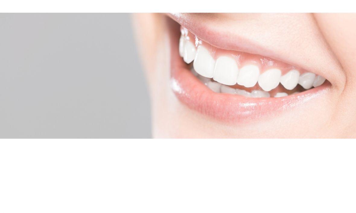 Bělení zubů Purewhitening